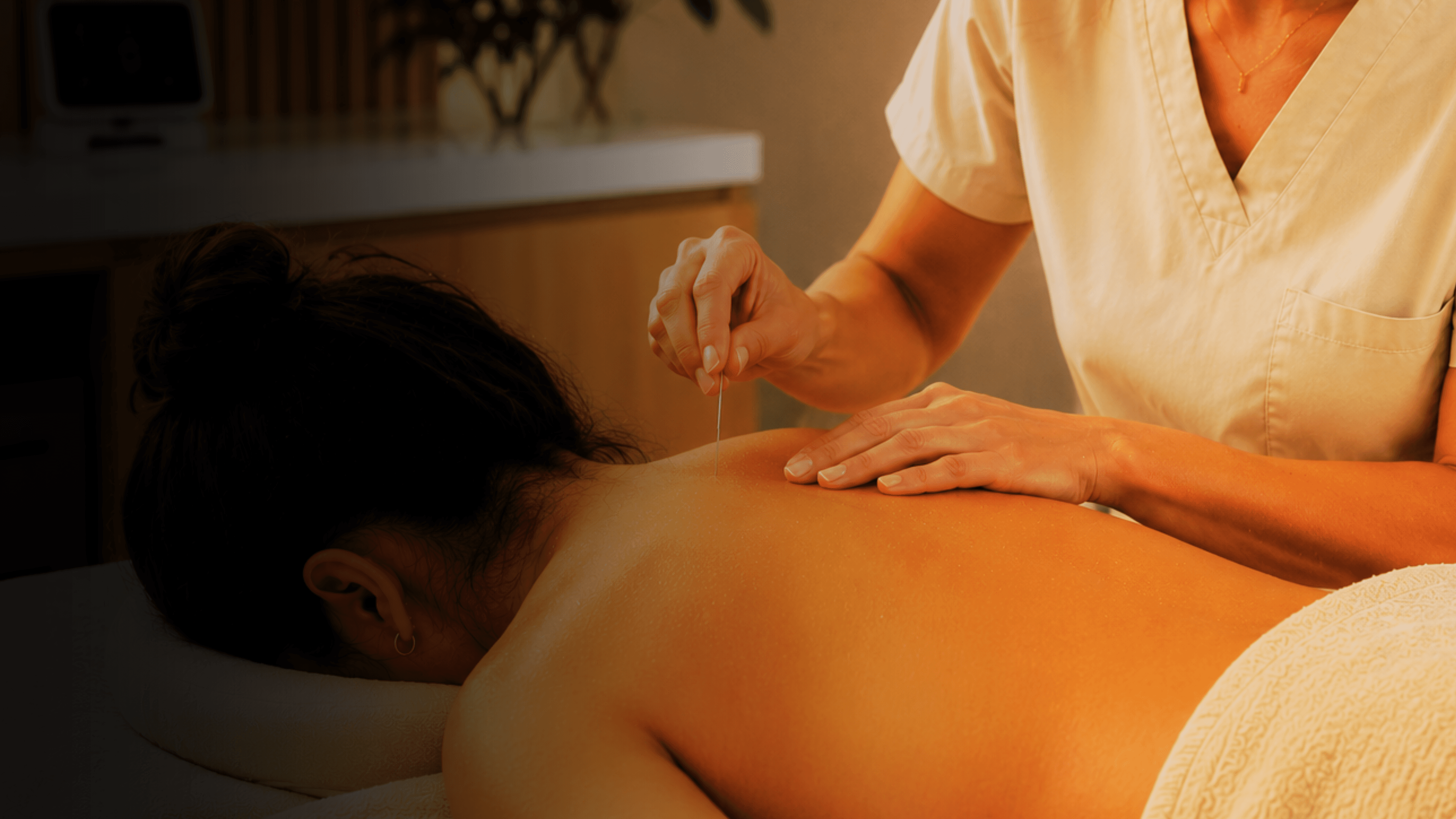 Acupuncture treatment in a calm wellness room